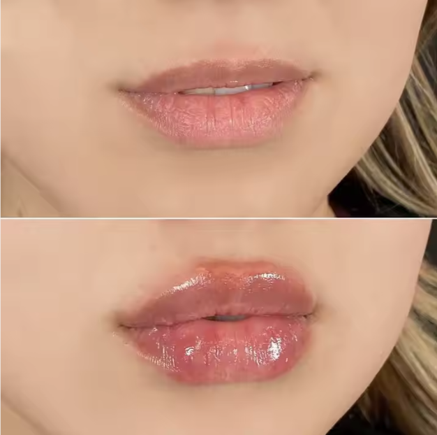 Lip plump extreme