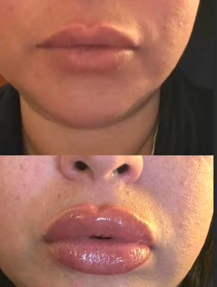 Lip Voluminizador x2 volumen