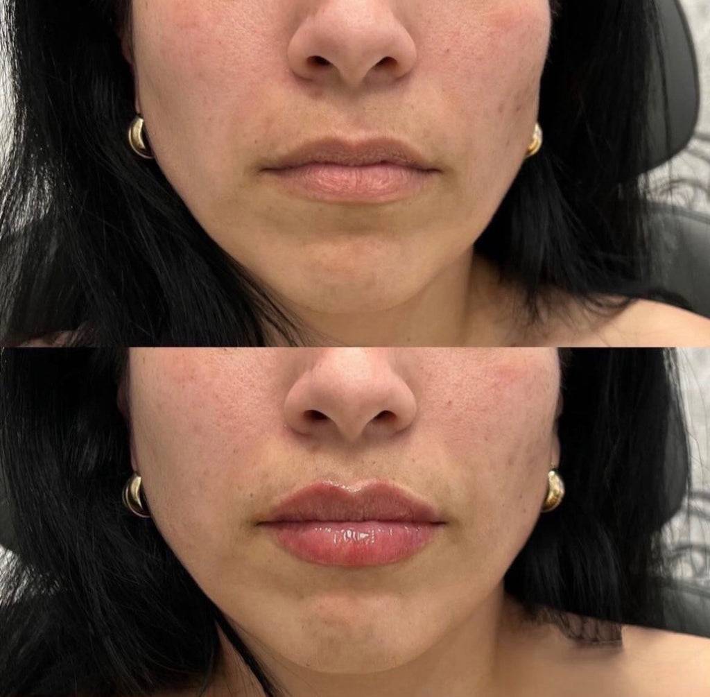 Lip Voluminizador x2 volumen