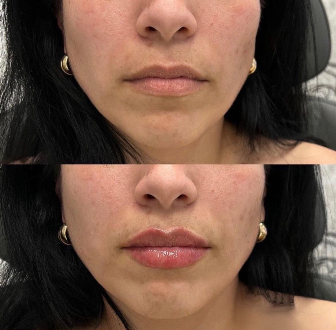 Lip Voluminizador x2 volumen